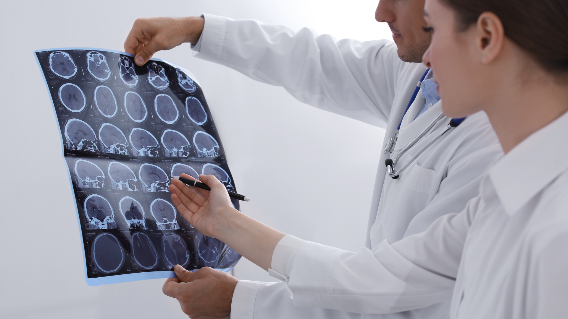 sclerosi multipla(1).png