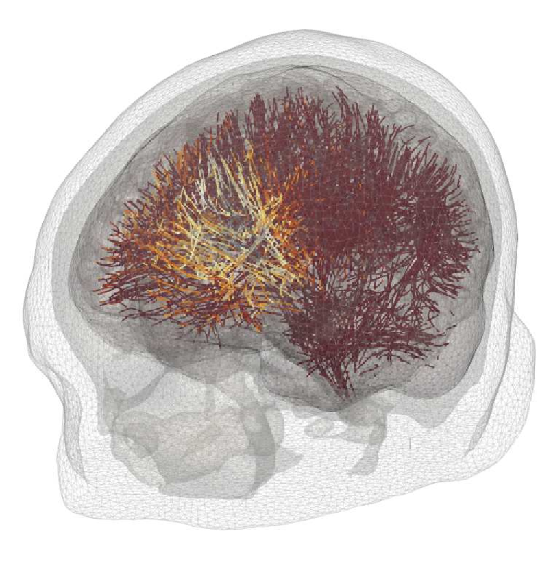 figura1-progetto-TurboEEG-Francesco-Andriulli.png