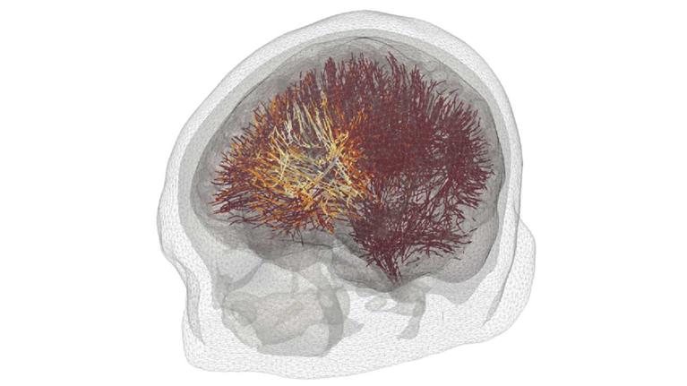ERC TurboEEG - EEG results example