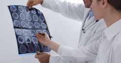 sclerosi multipla(1).png